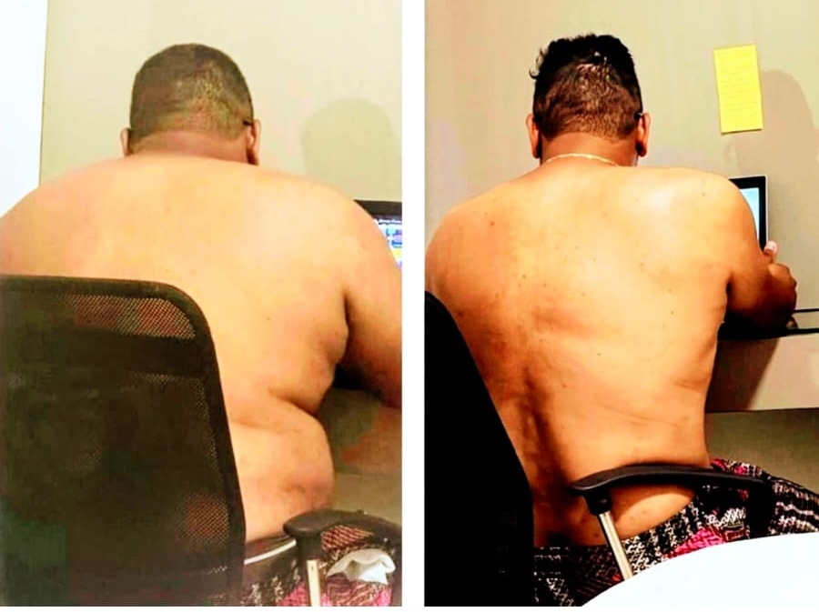 Resultado de emagrecimento -38kg