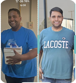 Resultado de emagrecimento -50kg